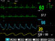E12 Multi Parameter Oscillometry Modular Patient Monitor , 12 Inch TFT Display nhà cung cấp