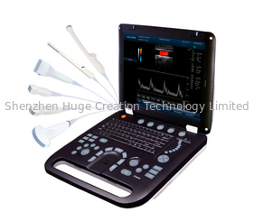 Trung Quốc 4D Color Doppler Ultrasound Scanner with 3.5MHz / R40 Volume Probe nhà cung cấp